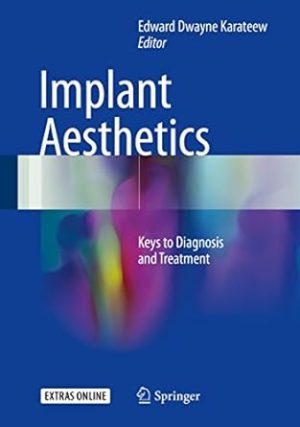 Implant Aesthetics Keys to Diagnosis and Treatment