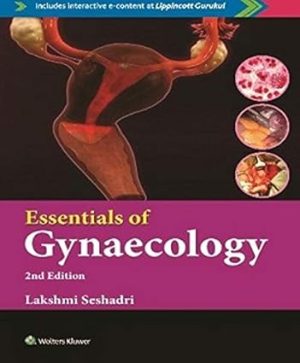Essentials of Gynaecology 2nd Edition