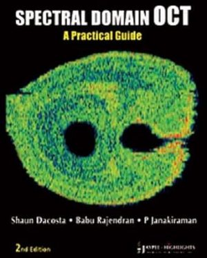 Spectral Domain OCT A Practical Guide