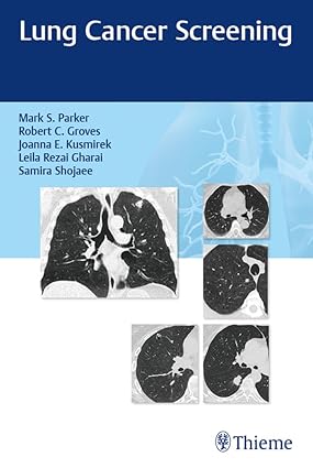 Lung Cancer Screening