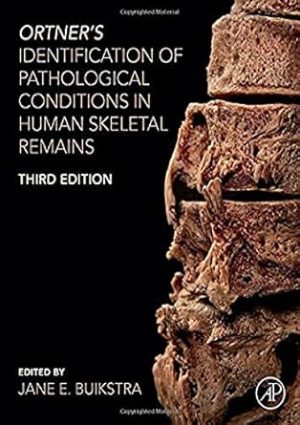 Ortners Identification of Pathological Conditions in Human Skeletal Remains 3rd Edition