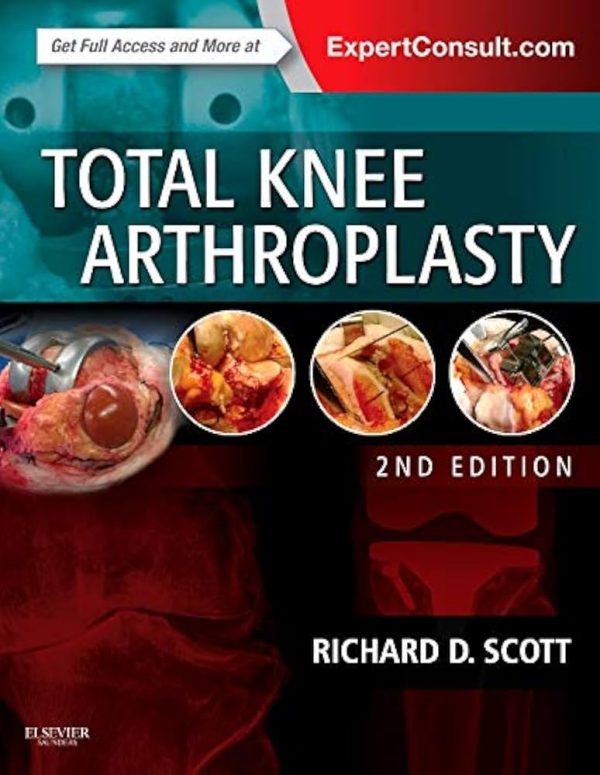 Total Knee Arthroplasty 2nd Edition