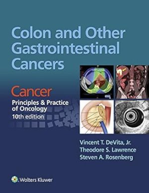 Colon and Other Gastrointestinal Cancers Cancer Principles & Practice of Oncology 10th Edition