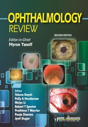 Ophthalmology Review 2nd Edition