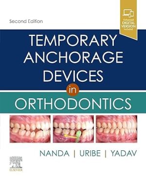 Temporary Anchorage Devices in Orthodontics 2nd Edition