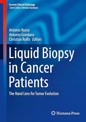 Liquid Biopsy in Cancer Patients The Hand Lens for Tumor Evolution