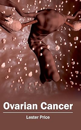 Ovarian Cancer By Robert E Bristow