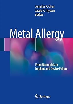 Metal Allergy From Dermatitis to Implant and Device Failure