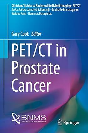 PET CT in Prostate Cancer