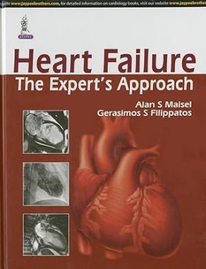 Heart Failure The Experts Approach