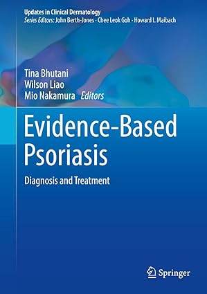 Evidence Based Psoriasis Diagnosis and Treatment