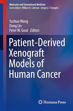 Patient Derived Xenograft Models of Human Cancer