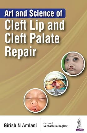 Art and Science of Cleft Lip and Cleft Palate Repair