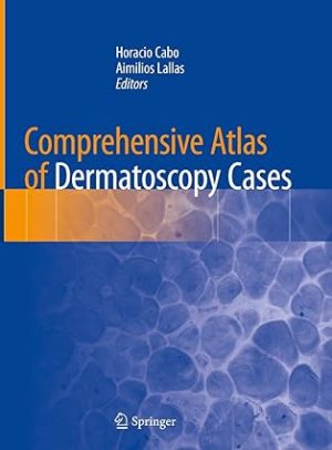 Comprehensive Atlas of Dermatoscopy Cases