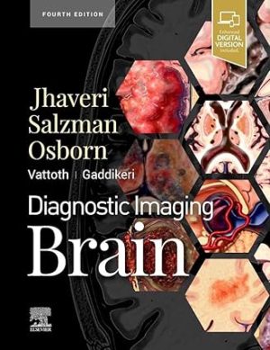 Diagnostic Imaging Brain