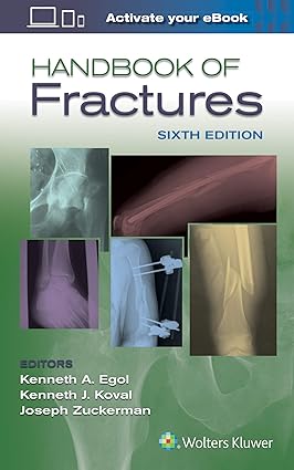 Handbook of Fractures 6th Edition
