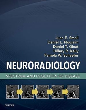 Neuroradiology Spectrum and Evolution of Disease