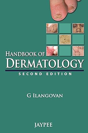 Handbook of Dermatology 2nd Edition