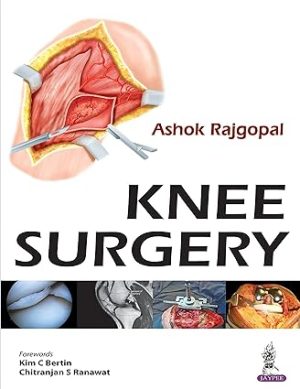 Knee Surgery by Ashok Rajgopal