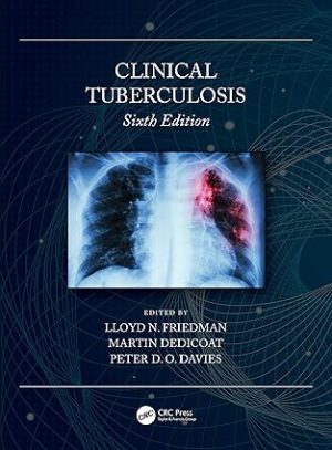 Clinical Tuberculosis