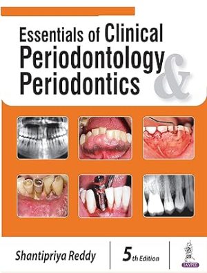 Essentials of Clinical Periodontology & Periodontics 5th Edition