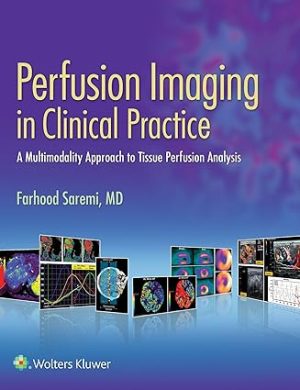 Perfusion Imaging in Clinical Practice