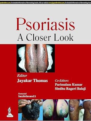 Psoriasis A Closer Look