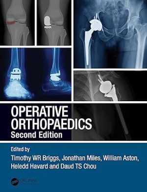 Operative Orthopaedics 2nd Edition