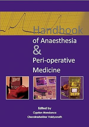 Handbook of Anaesthesia & Peri Operative Medicine