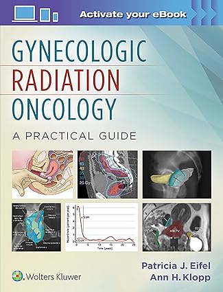 Gynecologic Radiation Oncology A Practical Guide