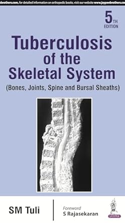 Tuberculosis of the Skeletal System