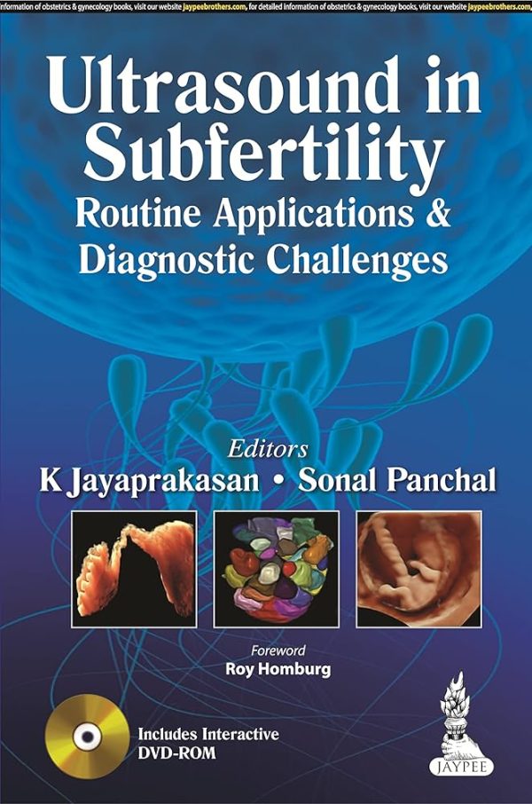 Ultrasound in Subfertility Routine Applications and Diagnostic Challenges