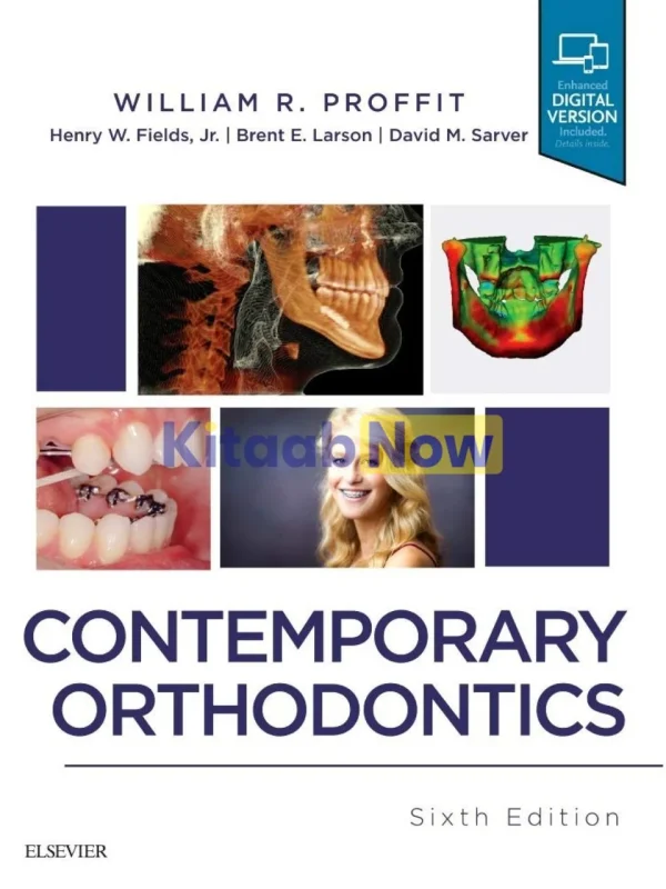 Contemporary Orthodontics 6th Edition