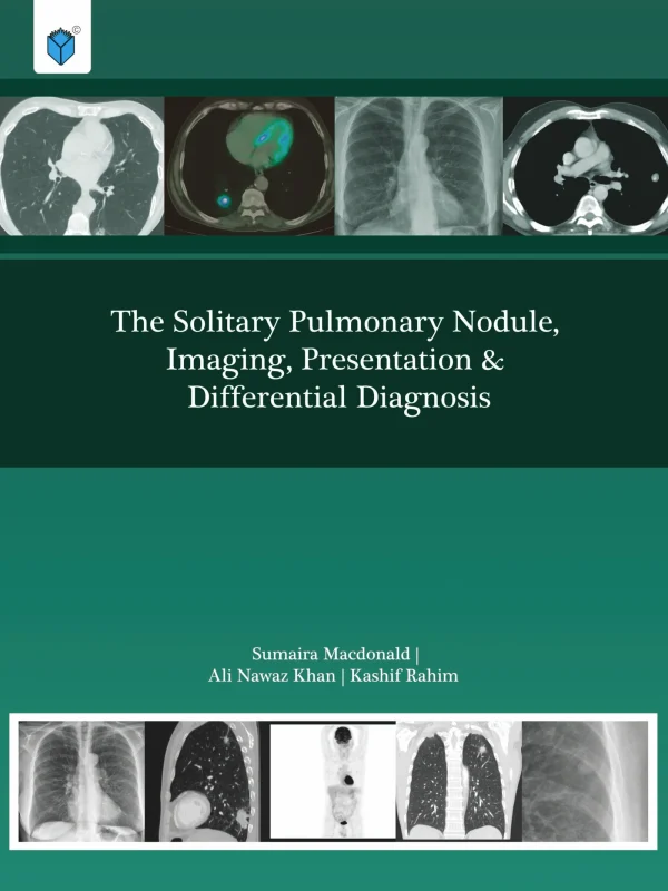 The Solitary Pulmonary Nodule Imaging Presentation & Diff Diagnosis