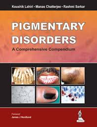 Pigmentary Disorders A Comprehensive Compendium