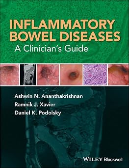 Inflammatory Bowel Disease A Clinicians Guide