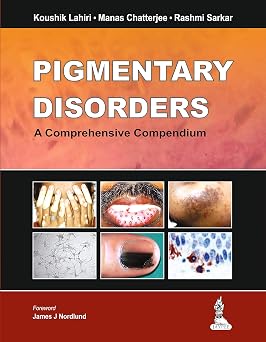 Pigmentary Disorders A Comprehensive Compendium