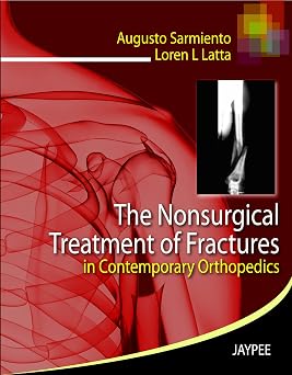 The Nonsurgical Treatment of Fractures in Contemporary Orthopedics