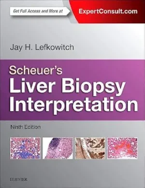 Scheuers Liver Biopsy Interpretation 9th Edition