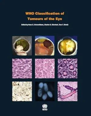 WHO Classification of Tumours of the Eye 4th Edition
