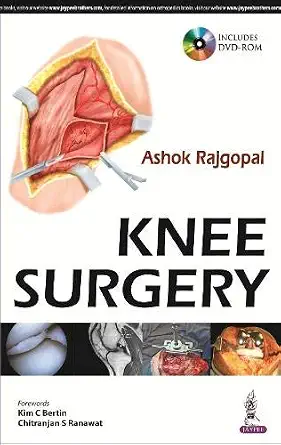 Knee Surgery by Ashok Rajgopal