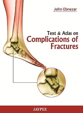 Text And Atlas On Complications Of Fractures