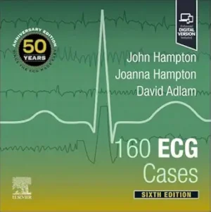 160 ECG Cases 6th Edition By John Hampton