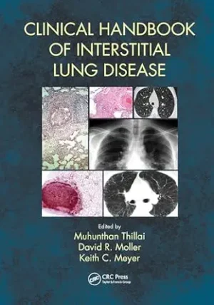 Clinical Handbook of Interstitial Lung Disease