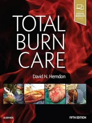 Total Burn Care 5th Edition