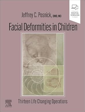 Facial Deformities in Children Thirteen Life Changing Operations