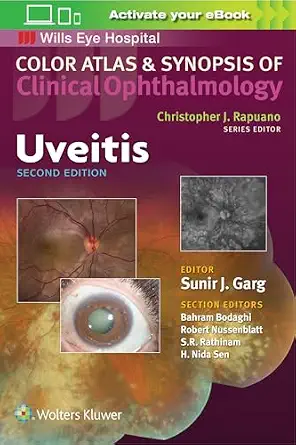 Uveitis 2nd Edition