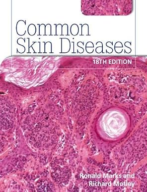 Roxburghs Common Skin Diseases 18th Edition