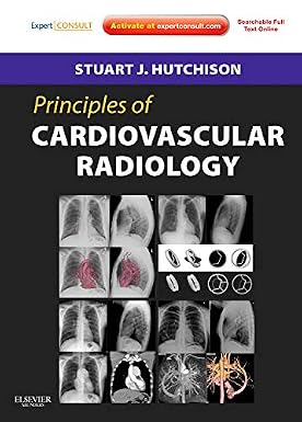 Principles of Cardiovascular Radiology