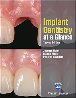 Implant Dentistry at a Glance